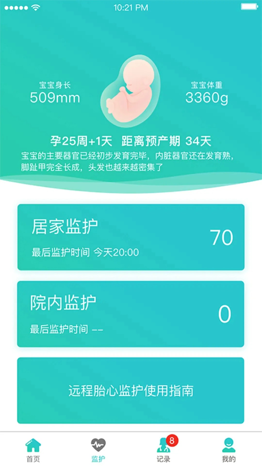 胎心监护 v1.0.24