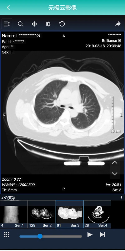 无极云影像 v1.0.5